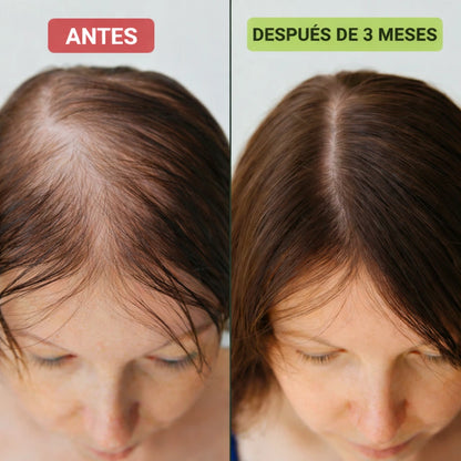 Sérum Capilar Regenerador Fórmula Avanzada